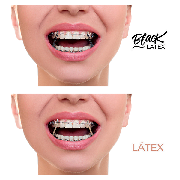 Black Antimicrobial Latex Intraoral Elastics Bulk