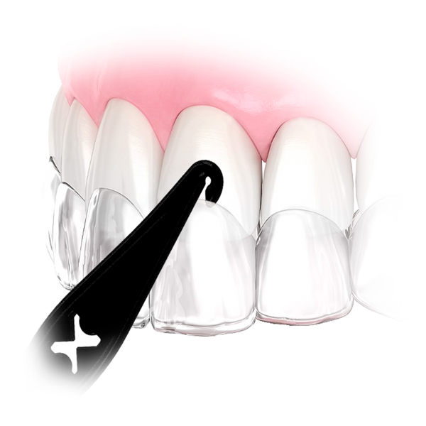 Elastics Placement Tool